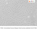 Immortalized Human Fallopian Tube Secretory Epithelial Cells (FT240) – Figure 1 of 1