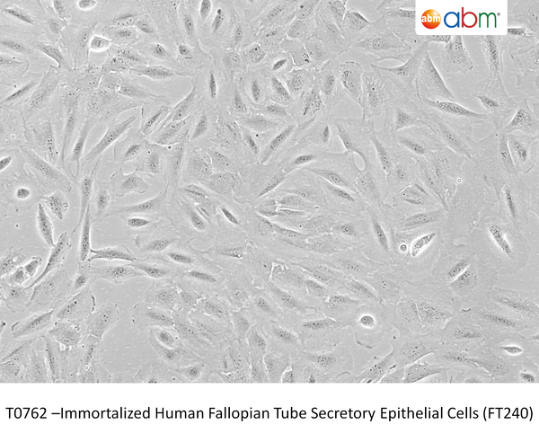 Immortalized Human Fallopian Tube Secretory Epithelial Cells (FT240) – Figure 1 of 1
