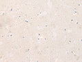 KCNIP3 Polyclonal Antibody – Figure 1 of 2