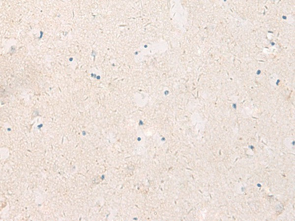 KCNIP3 Polyclonal Antibody – Figure 1 of 2