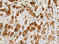 SAA1 Polyclonal Antibody – Figure 1 of 2