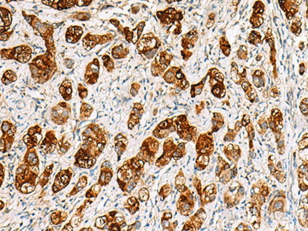 SAA1 Polyclonal Antibody – Figure 1 of 2