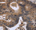 FGF21 Polyclonal Antibody – Figure 1 of 2