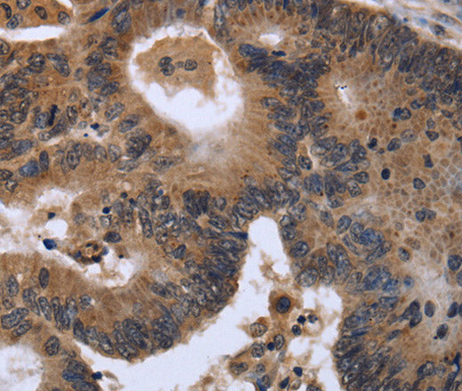 FGF21 Polyclonal Antibody – Figure 1 of 2