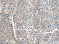 CLTCL1 Polyclonal Antibody – Figure 1 of 3