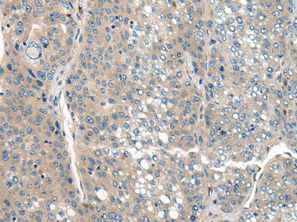 CLTCL1 Polyclonal Antibody – Figure 1 of 3