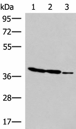GIMAP2 Polyclonal Antibody – Figure 1 of 3