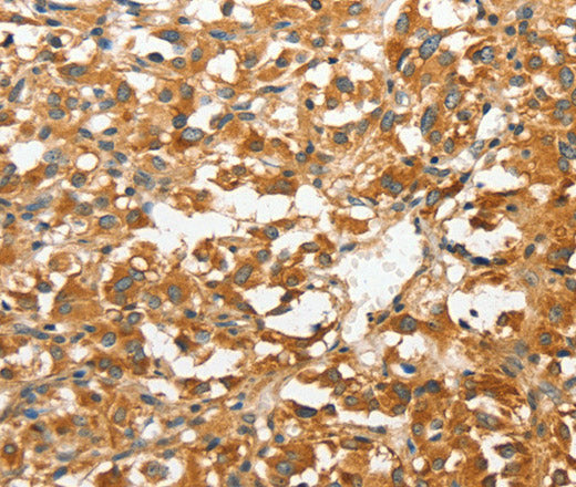 ANXA9 Polyclonal Antibody – Figure 1 of 3