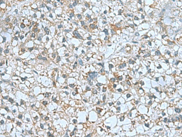 CNTN4 Polyclonal Antibody – Figure 1 of 2