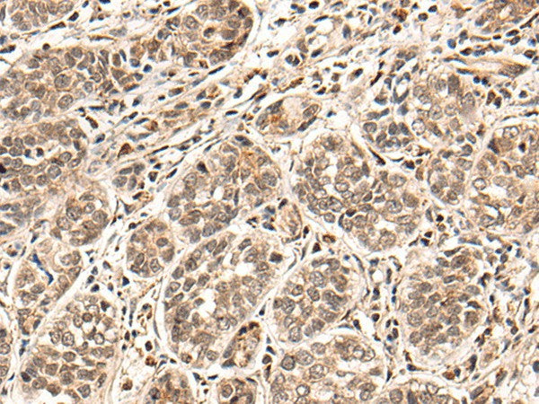 HGH1 Polyclonal Antibody – Figure 1 of 2