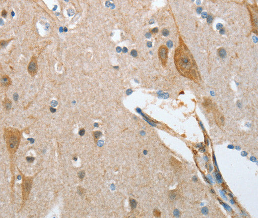 NOL3 Polyclonal Antibody – Figure 1 of 3