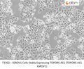 IGROV1 Cells Stably Expressing TOPORS-AS1 (TOPORS-AS1 IGROV1) | Applied Biological Materials (abm)