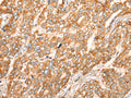 ZMYND10 Polyclonal Antibody – Figure 1 of 3