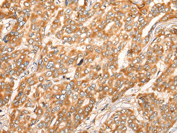 ZMYND10 Polyclonal Antibody – Figure 1 of 3