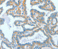 ASCC1 Polyclonal Antibody – Figure 1 of 3