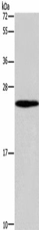 GUK1 Polyclonal Antibody – Figure 1 of 4