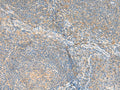 RNF207 Polyclonal Antibody – Figure 1 of 2