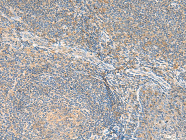 RNF207 Polyclonal Antibody – Figure 1 of 2