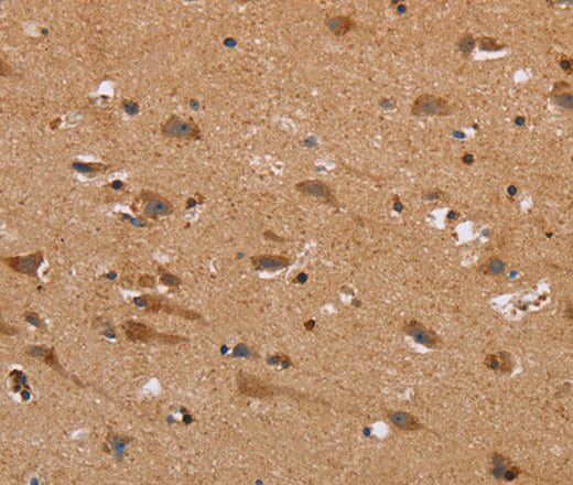 NDRG3 Polyclonal Antibody – Figure 1 of 3