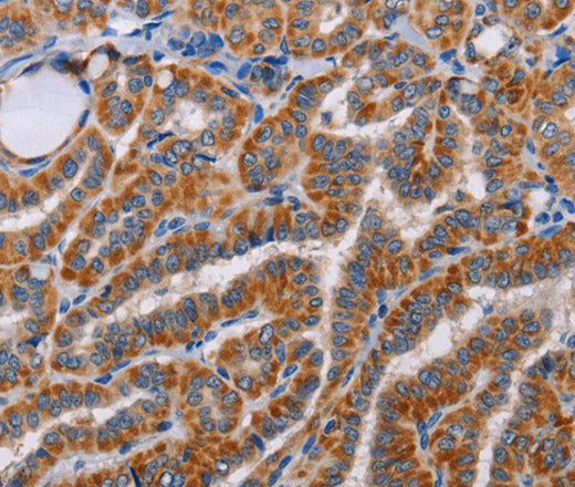 ALG9 Polyclonal Antibody – Figure 1 of 3