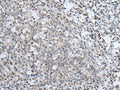 ABCA6 Polyclonal Antibody – Figure 1 of 2