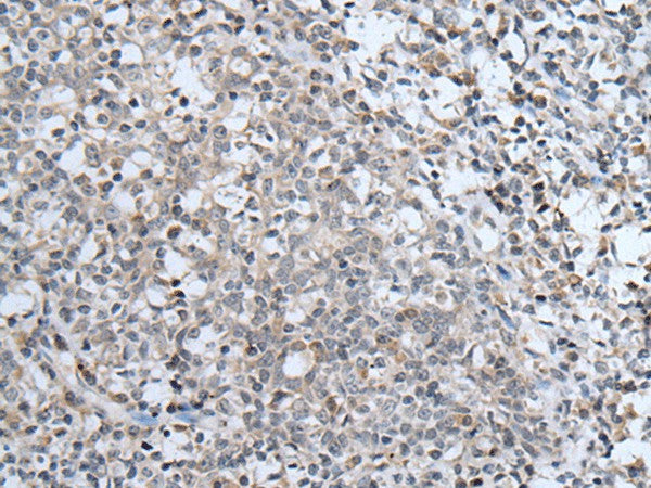 ABCA6 Polyclonal Antibody – Figure 1 of 2