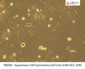 Squamous Cell Carcinoma Cell Line (UM-SCC-109) | Applied Biological Materials (abm)