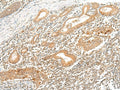 HLA-G Polyclonal Antibody – Figure 1 of 2