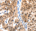 LRP5 Polyclonal Antibody – Figure 1 of 2