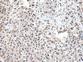 UBE2E3 Polyclonal Antibody – Figure 1 of 3