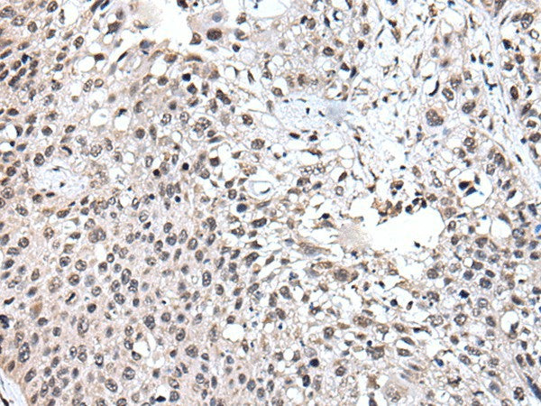 UBE2E3 Polyclonal Antibody – Figure 1 of 3