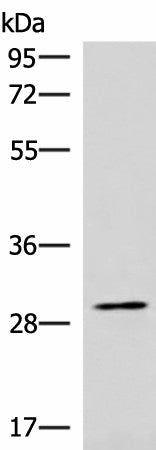 CDK4 Polyclonal Antibody – Figure 1 of 3