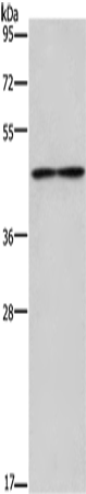 IL5RA Polyclonal Antibody – Figure 1 of 4