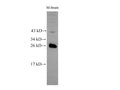 RAB5B Polyclonal Antibody – Figure 1 of 2