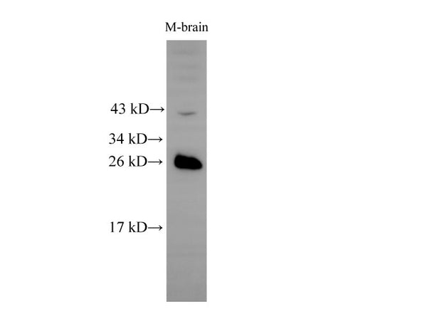 RAB5B Polyclonal Antibody – Figure 1 of 2