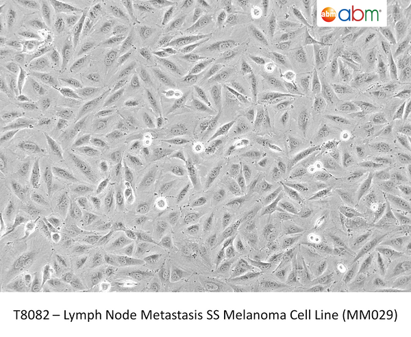Lymph Node Metastasis SS Melanoma Cell Line (MM029) | Applied Biological Materials (abm)