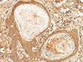 FIZ1 Polyclonal Antibody – Figure 1 of 3