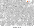 Immortalized Normal Human Glomerular Endothelial Cells (NhGEC) - SV40 – Figure 1 of 1