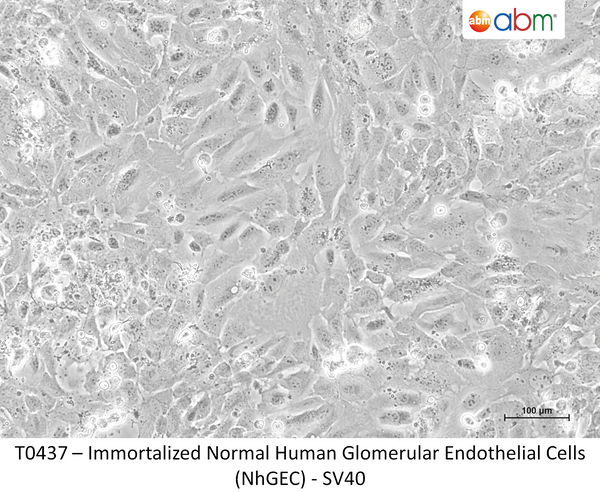 Immortalized Normal Human Glomerular Endothelial Cells (NhGEC) - SV40 – Figure 1 of 1