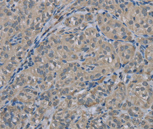 EDN1 Polyclonal Antibody – Figure 1 of 3