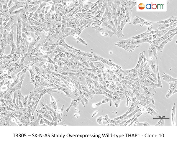 SK-N-AS Stably Overexpressing Wid-type THAP1 - Clone 10 – Figure 1 of 1