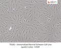 Immortalized Normal Schwann Cell Line (ipn02.3 (2λ)) - hTERT – Figure 1 of 1