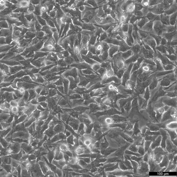 KHM-5M cell
