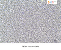 LuMa Cells – Figure 1 of 1