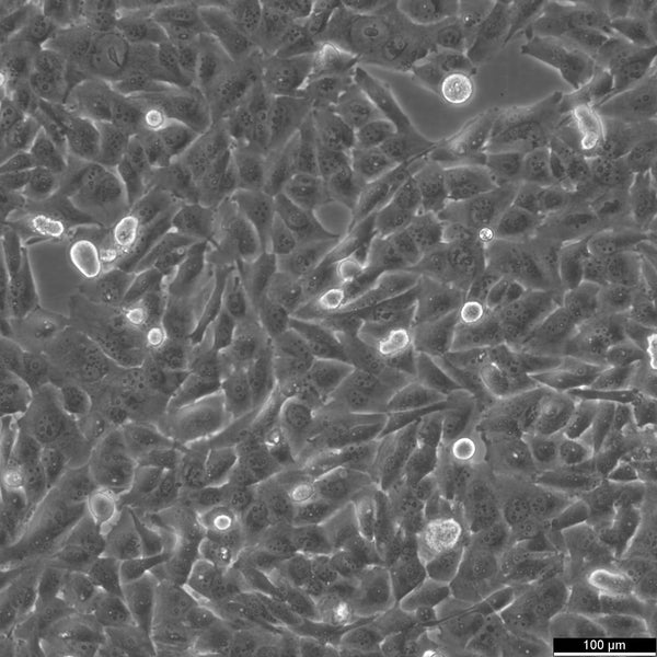 KMH-2 cell