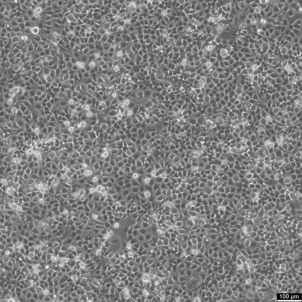 KYSE-150 cell