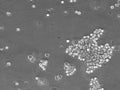 L-428 cell