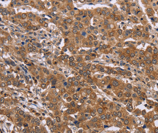 FAAH2 Polyclonal Antibody – Figure 1 of 3