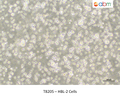 HBL-2 Cells – Figure 1 of 1