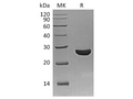 Recombinant Schistosoma Japonicum GST 26 Protein – Figure 1 of 2